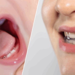 EOM Academy - Corso L'approccio osteopatico alle funzioni orali